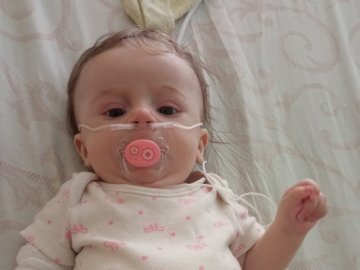 Семимісячній волинянці збирають гроші на найдорожчий у світі препарат Zolgensma, щоб вона вижила