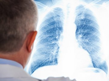 Хворих на туберкульоз волинян, які виїхали за кордон, лікуватимуть через Skypе