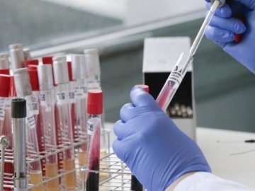 За добу в Україні – 2476 нових випадків коронавірусу, на Волині – 65