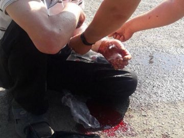 Респект і «вічне прокляття»: історія про небайдужість від речниці луцьких патрульних