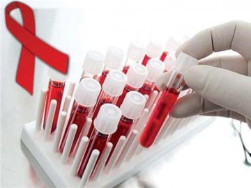 28 липня у центрі Луцька безплатно тестуватимуть на вірусні гепатити та ВІЛ
