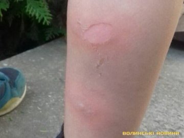 Дитина отримала опіки у луцькій маршрутці