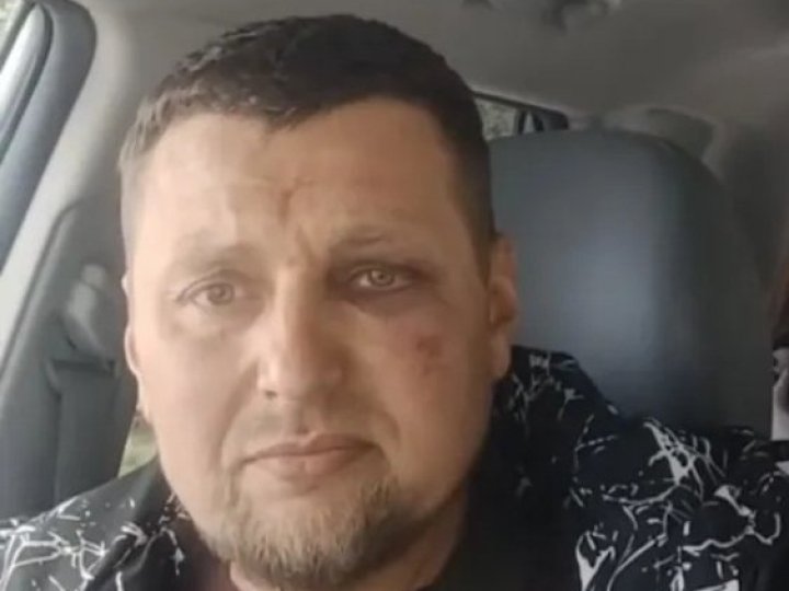 Побиття працівниками ТЦК та СП у Луцьку ветерана війни: справу розглядатимуть у ДБР