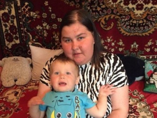 Молода мама з Волині бореться з раком: рідні просять допомоги