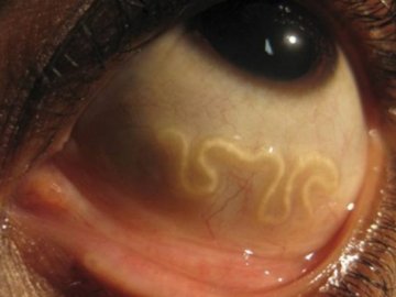 Через зміну клімату на Волині фіксують небачену раніше хворобу