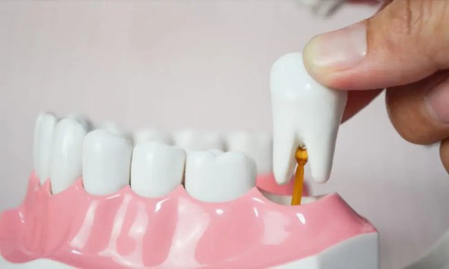 Що таке атравматичне видалення зубів