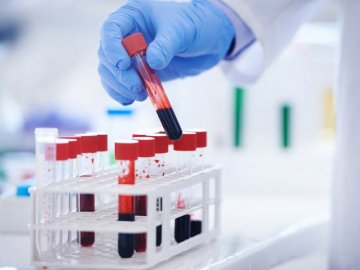 У лікарні на Волині медсестрам, які беруть кров у хворих на коронавірус, не доплачують – ЗМІ