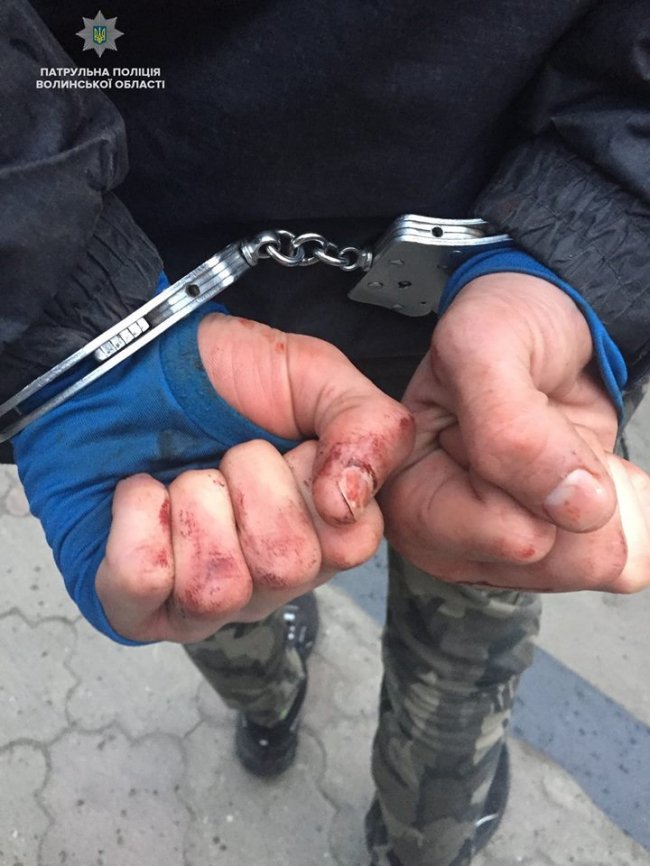 Потерпілого госпіталізували: у Луцьку п'яні підлітки побили та пограбували чоловіка. ФОТО