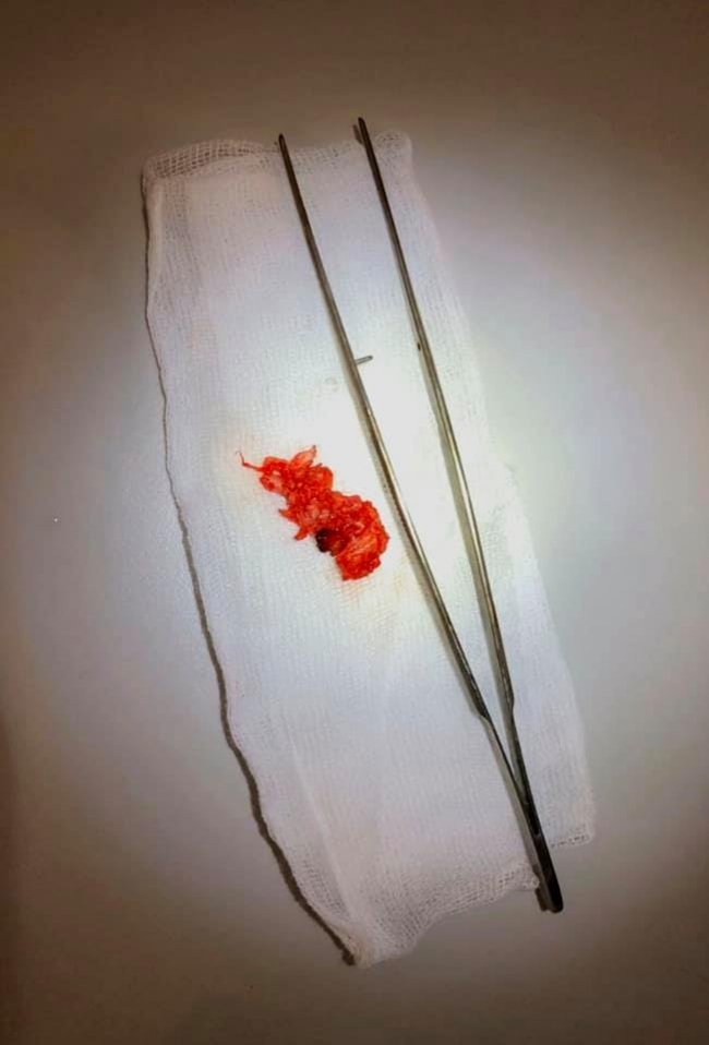 Зберегли можливість ходити: волинські лікарі повернули жінку до повноцінного життя. ФОТО