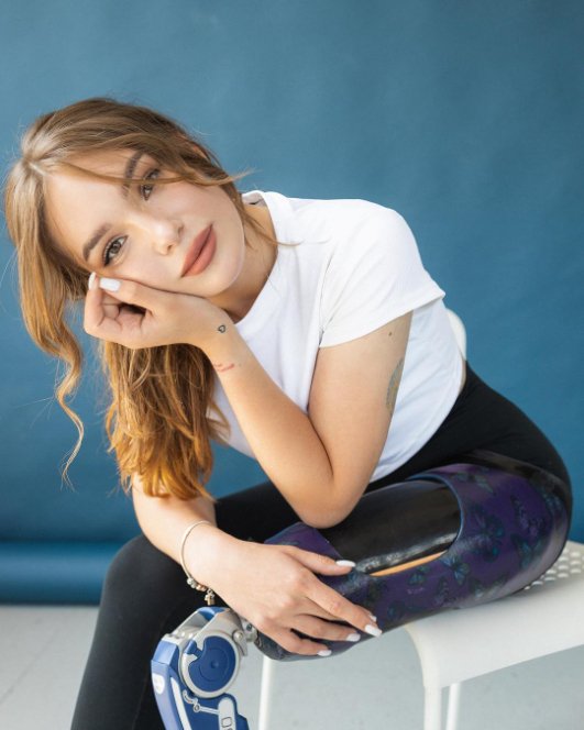 18-річна українка пішла на війну доброволицею і втратила ногу