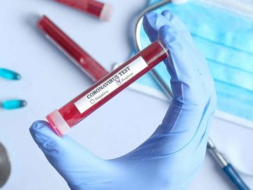 В Україні – 638 нових випадків коронавірусу, з них на Волині  – 9 