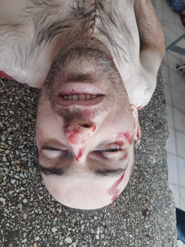 Під Луцьком вантажівка на смерть збила чоловіка: особу встановлюють. ОНОВЛЕНО. ФОТО 18+