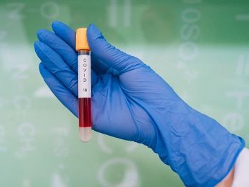 Цифри ковіду: повідомили статистику хвороби в Україні за добу