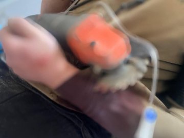 На Волині в лікарню привезли чоловіка з електропилою в руці 