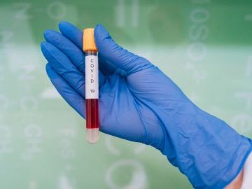 Повідомили статистику щодо коронавірусу в Україні за минулу добу