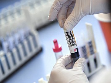 Де у Камінь-Каширському районі зафіксували нові випадки COVID-19