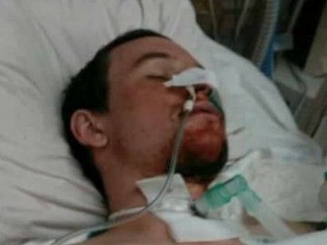 В зоні АТО важко поранили волинянина