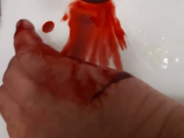 У Києві невідомі з ножем напали на продюсера Ягольника. ФОТО