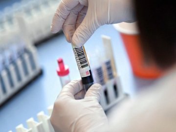 12 нових випадків коронавірусу у Любешівському районі: у яких селах виявили хворобу