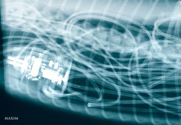 10 незвичайних рентгенівських знімків. ФОТО