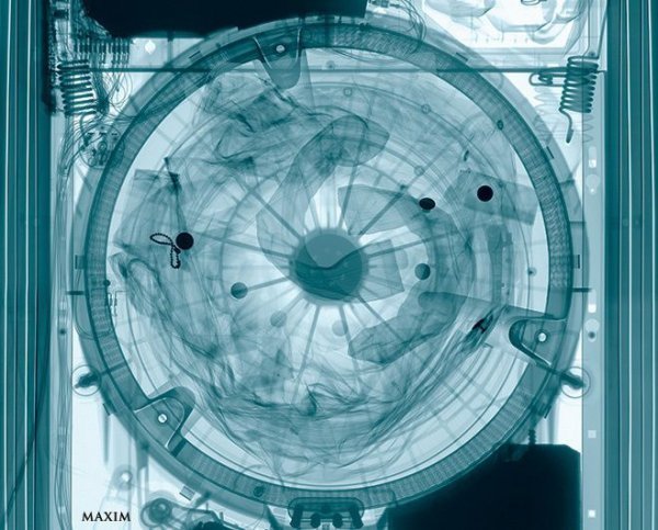 10 незвичайних рентгенівських знімків. ФОТО