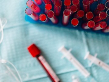 «Тенденція до збільшення показників»: розповіли про ситуацію з коронавірусом на Волині 