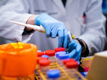 Ранок 25 серпня: в Україні – 1658 нових випадків коронавірусу, на Волині – 40 