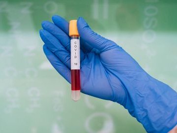 Оприлюднили статистику щодо коронавірусу в Україні за минулу добу