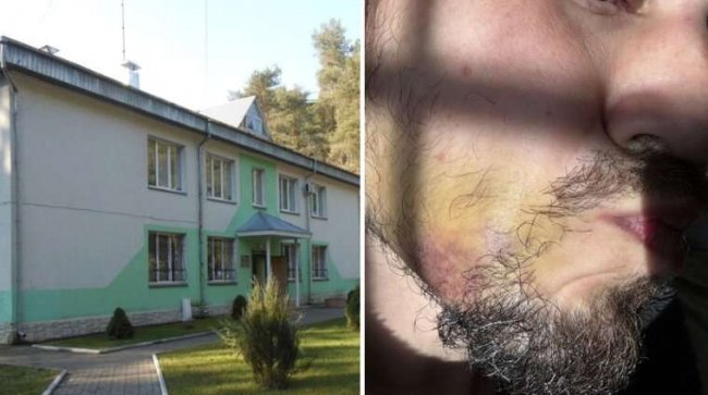 Катують та вимагають гроші: бізнесмен-біженець став заручником у Волинському ПТПІ