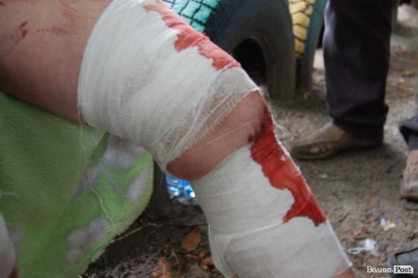 Обвал будинку в Луцьку. ФОТО