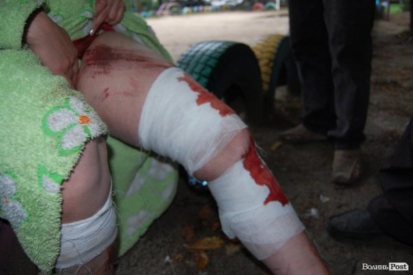 Обвал будинку в Луцьку. ФОТО