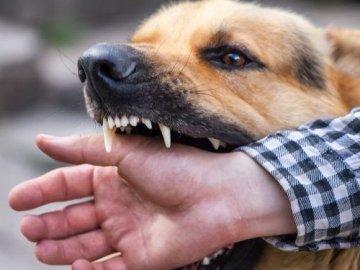 На Волині торік медики зареєстрували понад 1,8 тисячу звернень з приводу нападу тварин