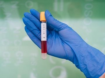 За добу в Україні виявили понад 20 тисяч інфікованих коронавірусом