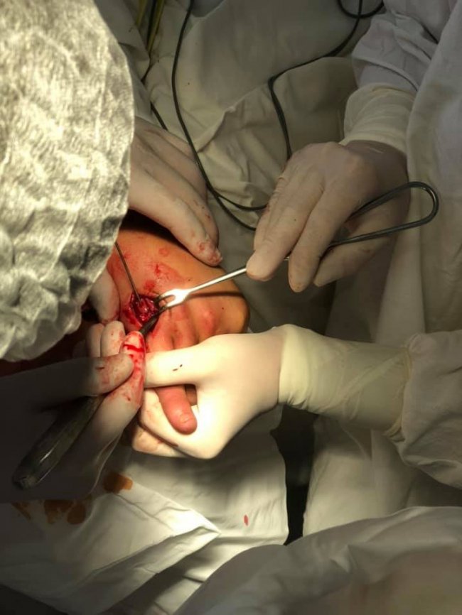 Волинські лікарі прооперували 18-річного хлопця, що невдало побоксував. ФОТО 18+