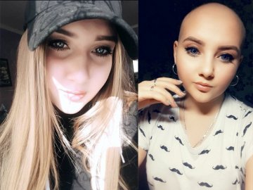 Друзі онкохворої дівчини з Волині влаштовують благодійну поїздку до Львова