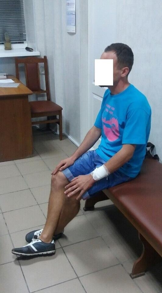 Лучанин порізав собі вени через зраду коханої. ФОТО