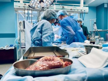 Скільки коштуватимуть операції з пересадки органів у 2024 році, які оплачує держава