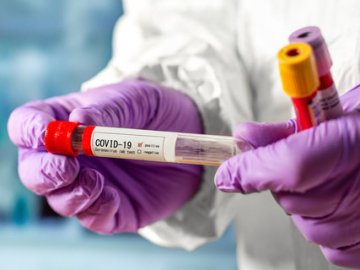 Повідомили, скільки заражених COVID-19 виявили в Україні за останню добу