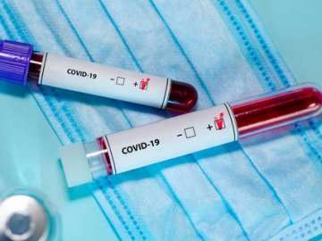 Нові захворілі на коронавірус у Ківерцівському районі контактували з поліцейськими із COVID-19