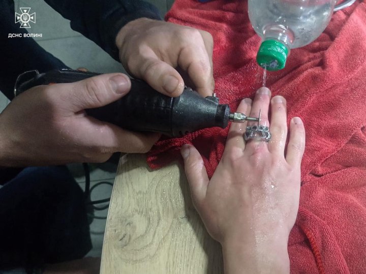 На Волині рятувальники допомогли зняти каблучку 17-річному хлопцю