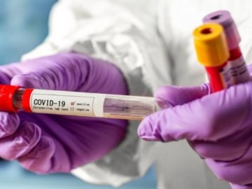 Коронавірус на Волині:  повідомили про ситуацію за минулу добу