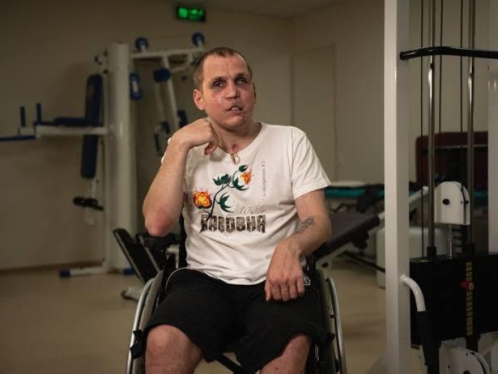 «Або видаляємо око, або ти помреш»: ветеран розповів, як після тяжкого поранення втратив зір