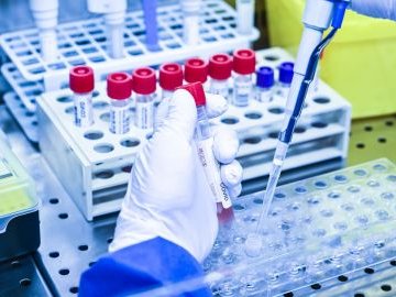 Повідомили статистику щодо COVID-19 в Україні за минулу добу