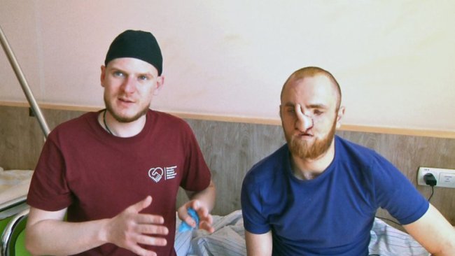 Волинські лікарі з канадськими колегами відновлюють обличчя пораненому воїну. ВІДЕО