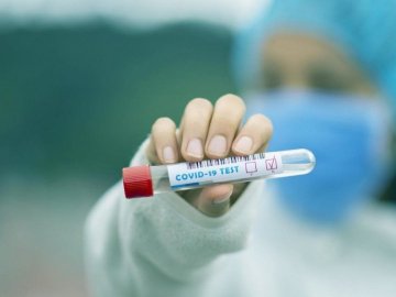 Оприлюднили статистику щодо коронавірусу в Україні за минулу добу