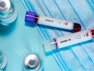 Ситуація з коронавірусом на Волині станом на 17 липня