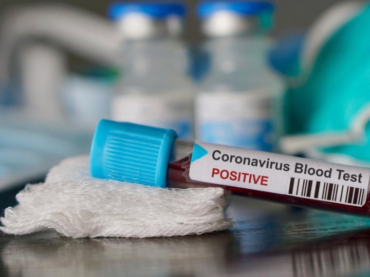 Вірулентність коронавірусу зменшується, - директор Волинської інфекційки