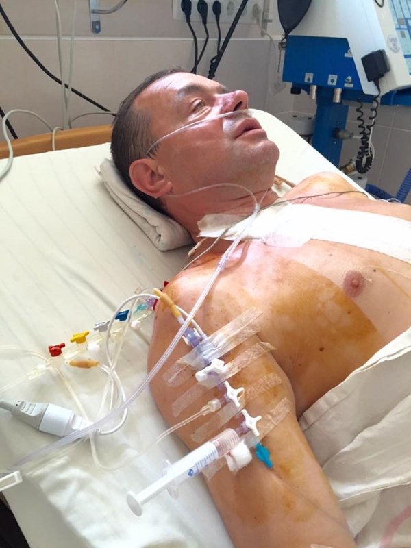 В обласній лікарні подарували друге життя волинському бійцю