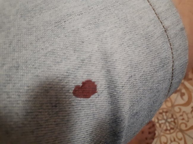 У Києві невідомі з ножем напали на продюсера Ягольника. ФОТО