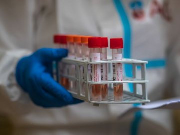 Повідомили статистику щодо коронавірусу в Україні за минулу добу